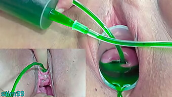 Japanese Lesbian Couple Explores Kinky Bdsm With Cervix And Urethral Injections